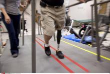 Un homme avec une prothèse de jambe.