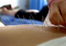 Seuls les médecins, sages-femmes et dentistes formés à l'acupuncture à l'université sont autorisés à