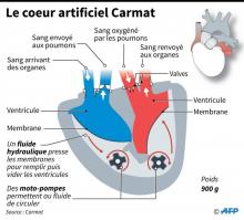 Coupe du coeur artificiel total de la société française Carmat