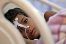 Un enfant atteint de diphthérie reçoit un traitement dans un hôpital de la capitale yéménite Sanaa, 