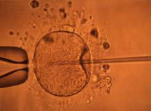 L'injection in vitro d'un spermatozoïdes dans un ovule.