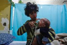 Un jeune Syrien porte un masque à oxygène au visage d'un bébé dans un hôpital de Douma, dans la Ghouta orientale, à l'est de Damas, après une attaque chimique présumée imputée au régime, le 22 janvier