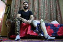 Karrar Hassan, 25 ans, qui fait partie des dizaines de milliers de militaires irakiens blessés dans les combats contre les jihadistes, est assis dans son salon à Bagdad, le 16 janvier 2018