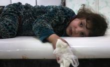 Une fillette syrienne blessée et en état de choc dans une clinique de fortune après des bombardements du régime à Douma, dans la Ghouta orientale, le 22 février 2018