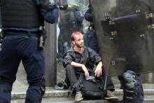 Un manifestant blessé lors des manifestations de la fonction publique à Paris, le 22 may 2018