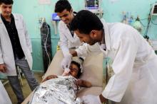 Des médecins soignent un enfant yéménite blessé lors d'une attaque aérienne, dans une clinique de Saada, le 8 août 2018