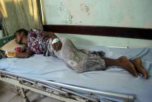 Un Yéménite blessé reçoit des soins après l'attaque aérienne de Hodeida, le 3 août 2018