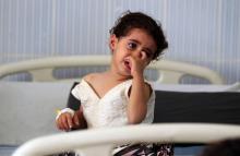 Une jeune fille souffrant de diphtérie dans un hôpital de la capitale yéménite Sanaa le 31 octobre 2018