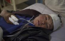 Un garçon afghan est soigné dans un hôpital de Kaboul le 7 mars 2019 après une attaque au mortier contre un rassemblement politique