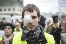 Franck Didron, un gilet jaune eborgné par un tir de la police, le 2 février 2019 lors d'une manifestation à Paris