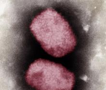 Virus de l'orthopoxvirose simienne (variole du singe)