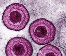Virus varicelle-zona