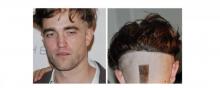 Robert Pattinson s'est rasé une partie de la tête.