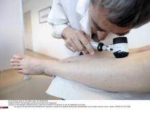 Un dermatologue analyse les grains de beauté sur la peau d'une patiente.
