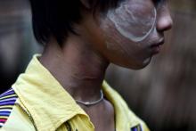 Birmanie enfants esclaves maltraitance brûlure