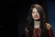 Reshma Bano Qureshi, 20 ans, survivante indienne d'une attaque à l'acide et modèle lors d'un défilé 