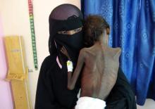 Une mère yéménite Nadia Nahari tient son fils de 5 ans souffrant de malnutrition sévère lors d'une consultation dans un hôpital de Khokha, dans l'ouest du Yémen le 22 novembre 2018