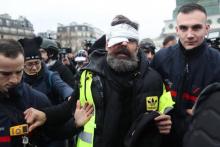 Jérôme Rodrigues,blessé à l'oeil lors de la manifestation à Paris, le 26 janvier 2019
