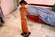 Fatima Hadi, une Yéménite déplacée de 12 ans souffrant de malnutrition aiguë, est pesée dans un hôpital de la province de Hajjah (nord-ouest) la 25 février 2019