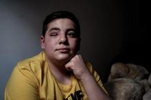 Mohammad, un jeune réfugié syrien qui a perdu son oeil droit en marge d'une manifestation, le 11 avril 2019 à Saint-Etienne