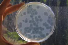 Des bactéries de type staphylocoque