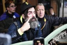 Jérôme Rodrigues, une figure des "gilets jaunes", légèrement blessé à un oeil après avoir été touché par le bouclier d'un CRS lors de l'acte 59 de ce mouvement social, le 28 décembre 2019 à Paris