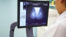Une intelligence artificielle serait capable de diagnostiquer des cancers du sein avec plus de précision qu'auparavant